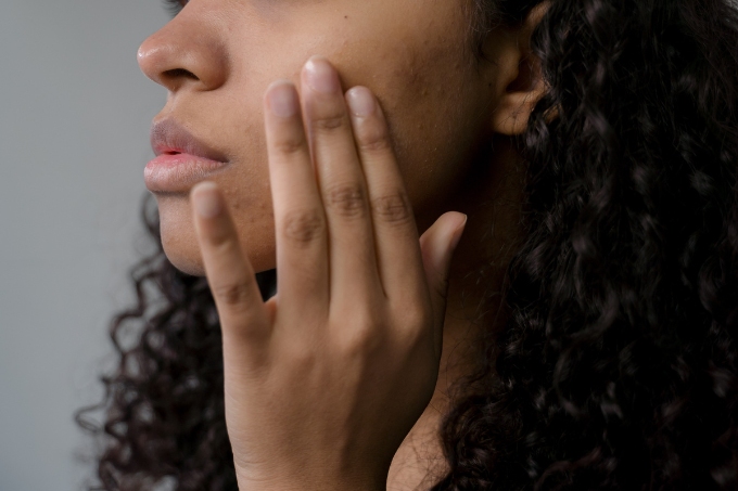 glow-naturally-remove-face-spots-with-expert-natural-remedies
